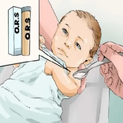 اسهال در اطفال