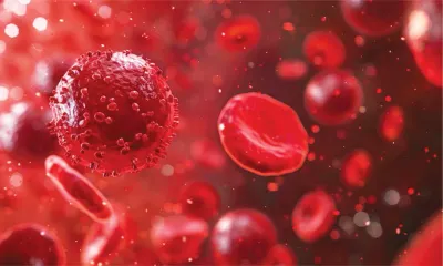 کلینیک انکولوژی - هماتولوژی